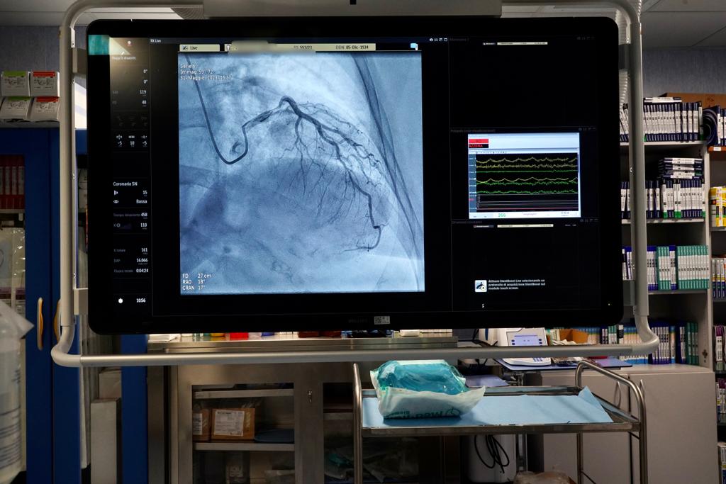 Galleria Cardiologia hi tech all’Ospedale Di Venere: installati due nuovi angiografi con tecnologia digitale - Diapositiva 11 di 12